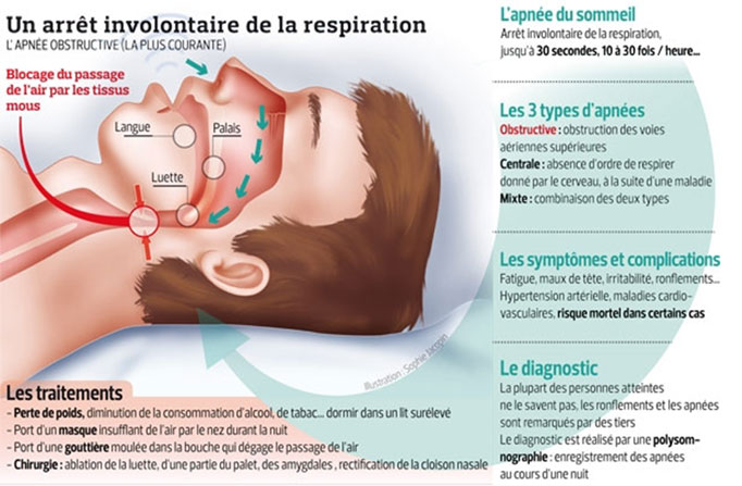 Schéma d'une Apnée